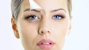 بررسی علل مختلف در تیرگی دور چشم