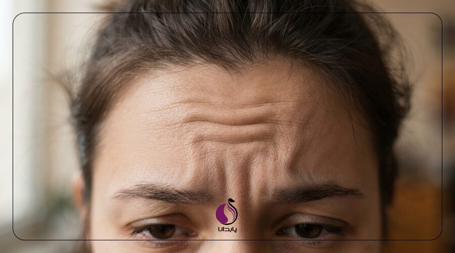 مهمترین علل چروک پوست در جوانی