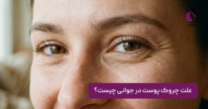 علت چروک پوست در جوانی چیست؟