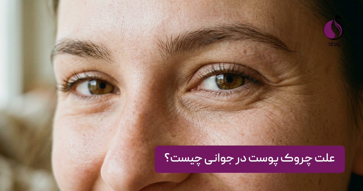 علت چروک پوست در جوانی چیست؟