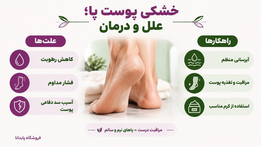 اینفوگرافیک علل و درمان های خشکی پوست پا