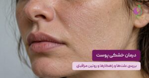 درمان خشکی پوست