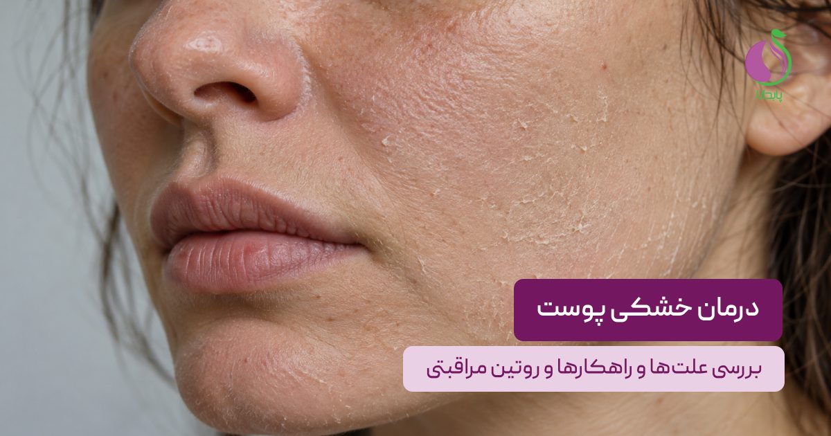 درمان خشکی پوست
