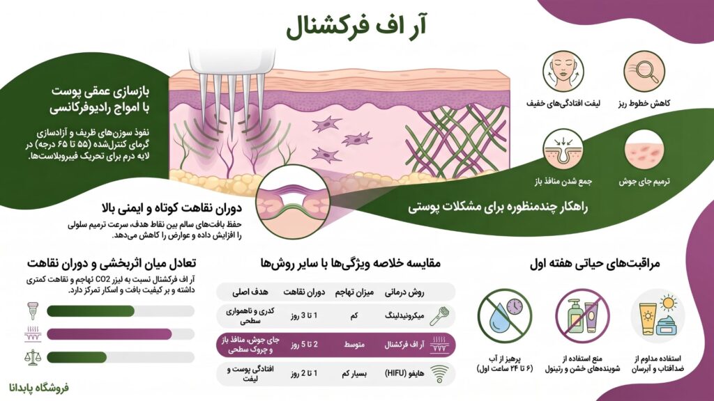اینفوگرافیک - آر اف فرکشنال