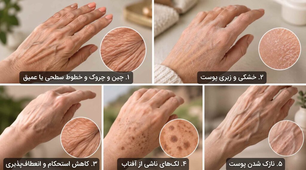 علائم پیری پوست دست