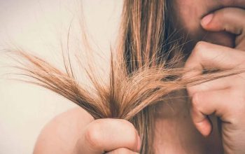 مو خوره چیست و چگونه درمان می شود؟